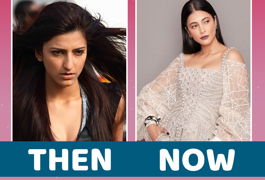 Heroines in Bollywood who swear by Cosmetic Surgery