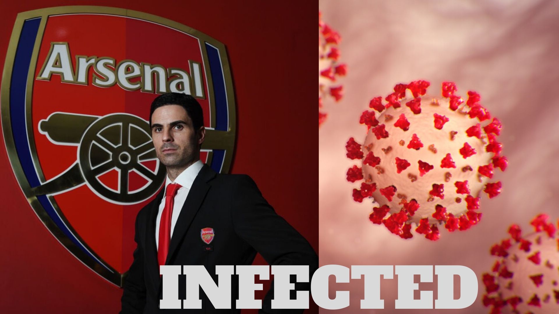 Arsenal manager Mikel Arteta