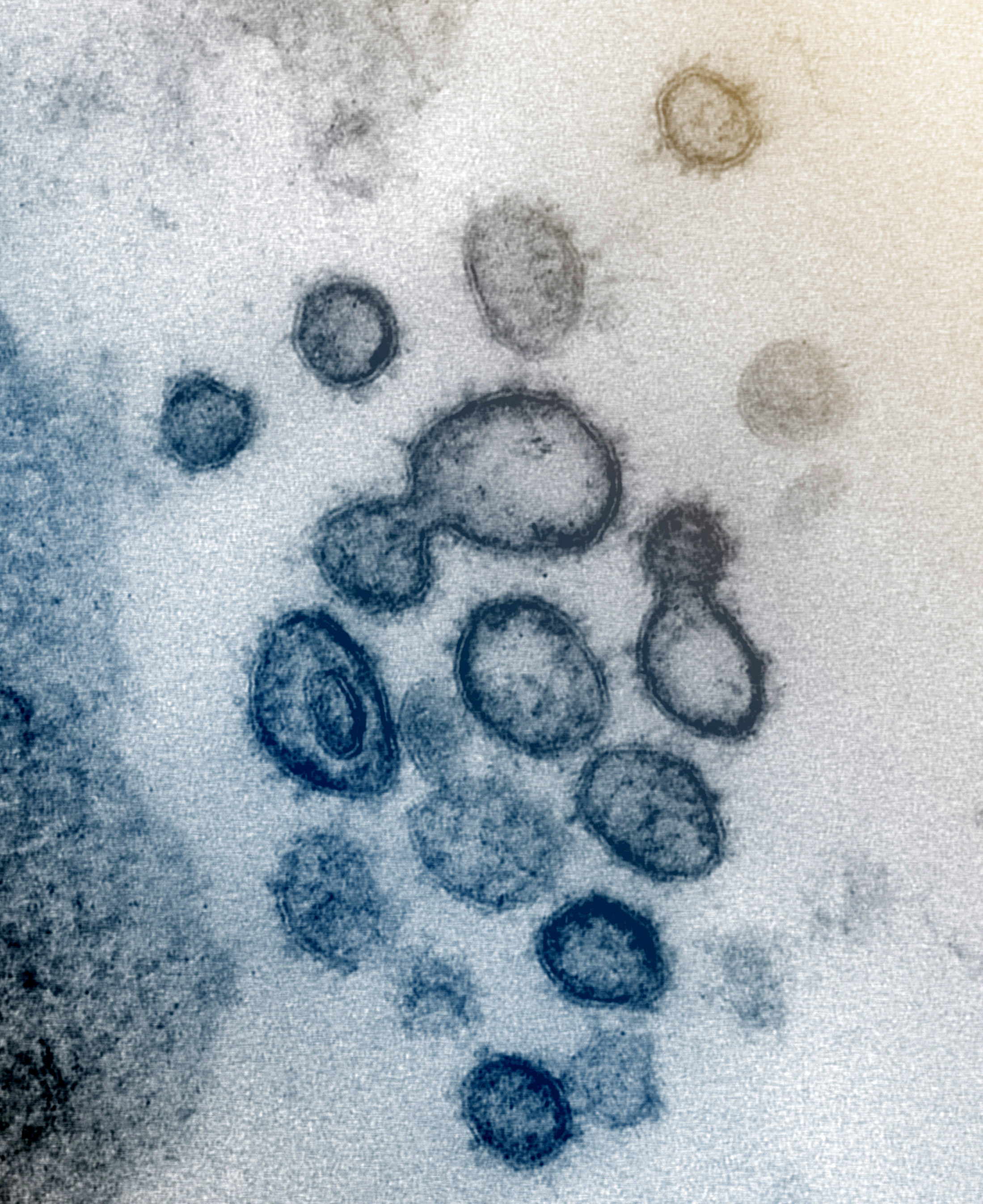 This undated electron microscope image made available by the US National Institutes of Health in February shows the Novel Coronavirus SARS-CoV-2. Also known as 2019-nCoV, the virus causes COVID-19.