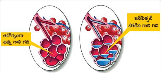 Kidneys