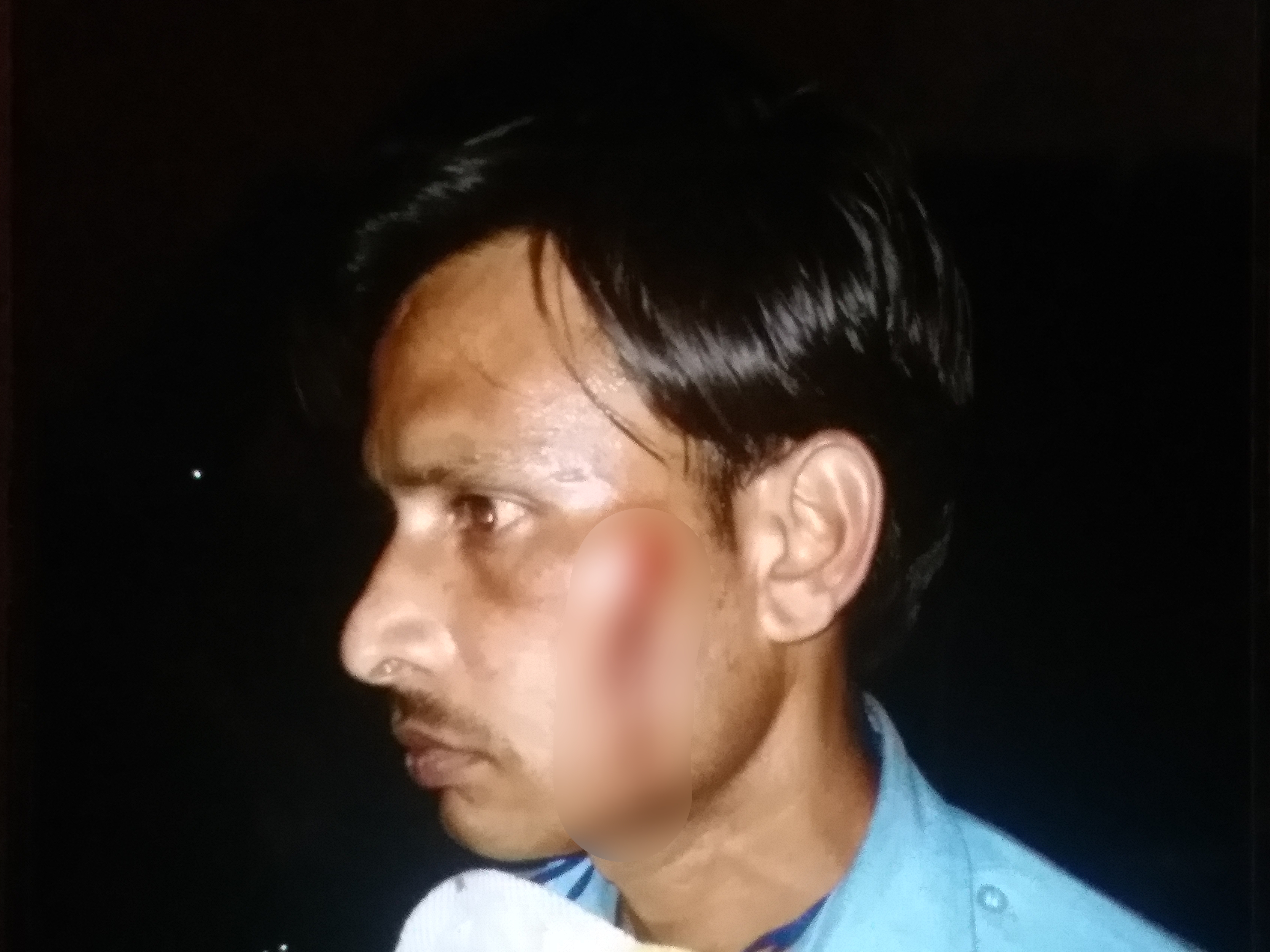 fight with guards at Ramnivas Bagh, Jaipur News