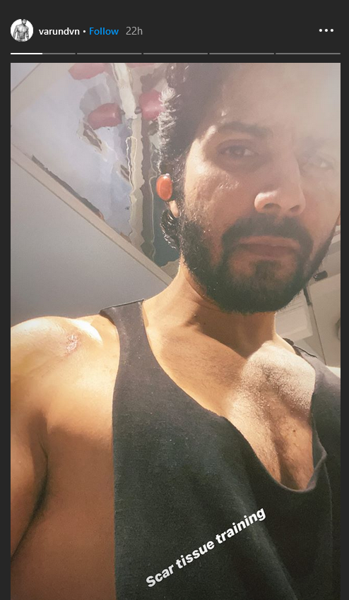 varun dhawan instagram story, ETVbharat