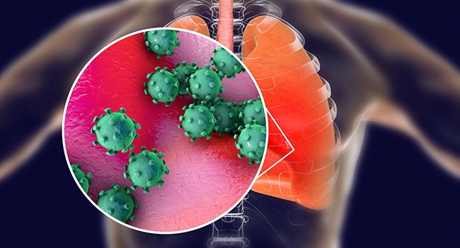 covid-19 long-term effects