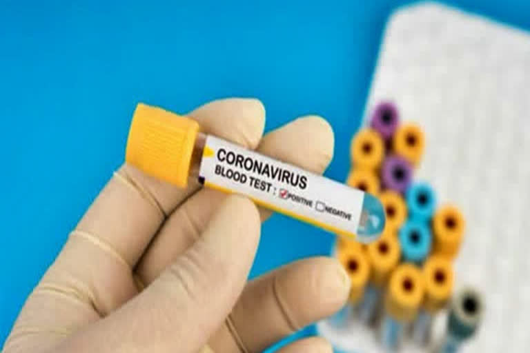 Coronavirus test