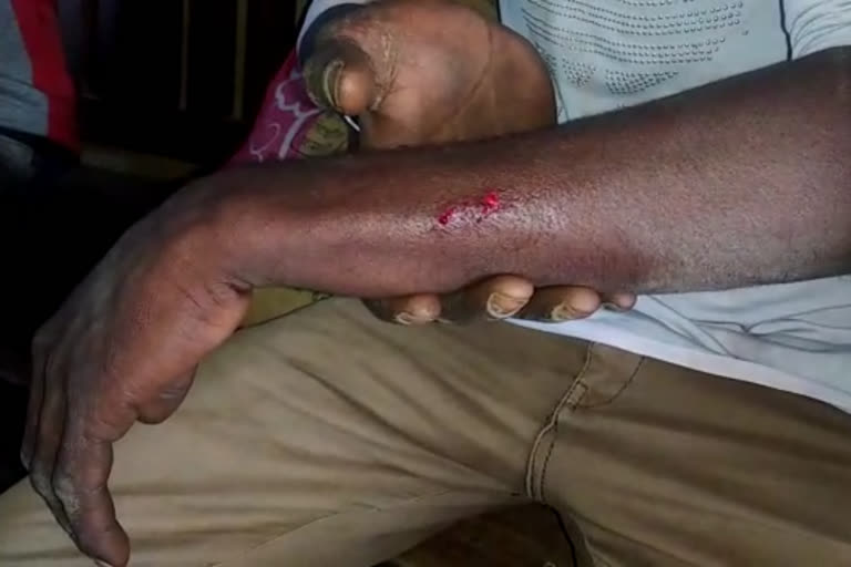 3 bjp worker allegdly attacked by tmc in garbeta