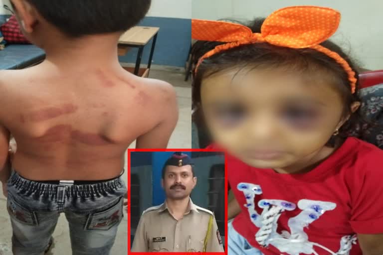 Step Mother and father beat children - Incident at Igatpuri in Nashik in Maharashtra