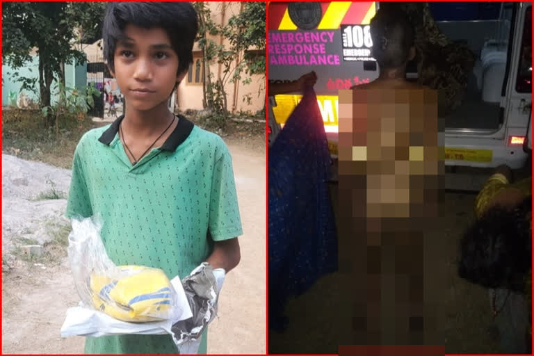 Hyderabad: Father sets his minor son on fire for not attending online classes