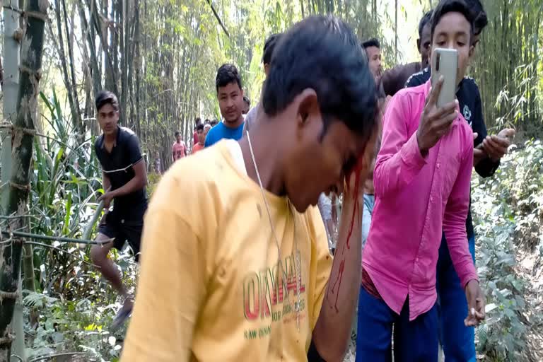 2 injured while leopard attacked in village