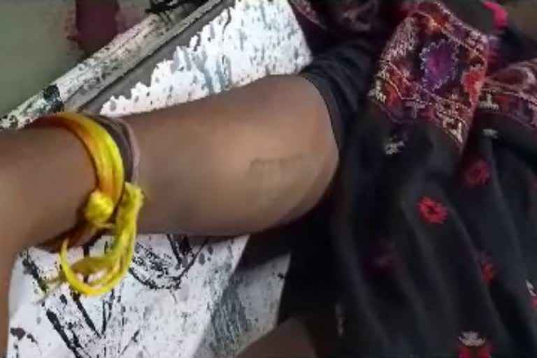 Young man commits suicide with writes his gf name on hand