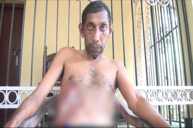 changanassery mental illness attack  changanasseri bus stand issue  bus employee attack mental person  ദേഹത്ത് ചൂട് വെള്ളം ഒഴിച്ച് ബസ് ജീവനക്കാരൻ  ചങ്ങനാശേരി ബസ് സ്റ്റാന്‍റ് അക്രമണം  മാനസിക ദൗർബല്യമുള്ള ആളുടെ ദേഹത്ത് ചൂട് വെള്ളം ഒഴിച്ചു  കോട്ടയം ചങ്ങനാശേരി ബസ് സ്റ്റാന്‍റ്