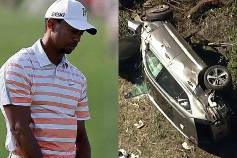 Tiger Woods in surgery with serious leg injuries after car accident