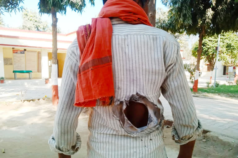 homegrown bomb thrown on man in jaunpur