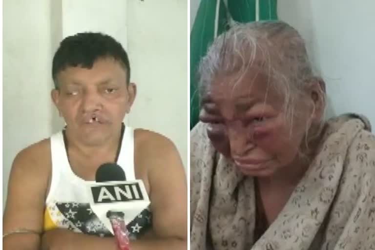 BJP worker alleges TMC workers of brutally attacking him  mother in Bengal's North Dumdum  കൊൽക്കത്ത  TMC workers of brutally attacking him, mother in Bengal's North Dumdum  BJP  BJP-TMC  തൃണമൂല്‍ കോണ്‍ഗ്രസ്