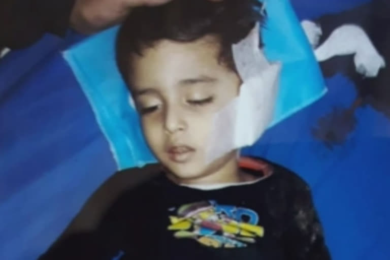 Hyderabad: Aunty threw a 3-year-old child down from a two-storey building