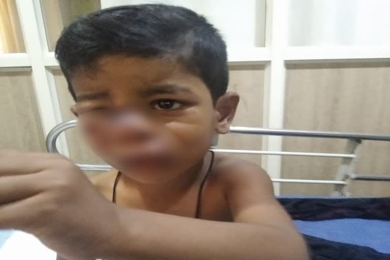 street-attack-on-little-boy-in-hubballi