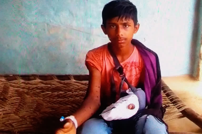 child finger blown off in an explosive in palamu