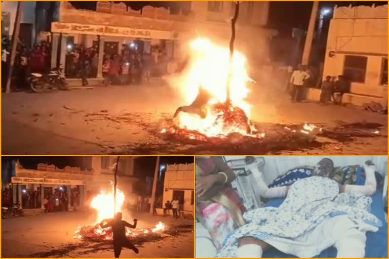 youth burnt during holika dahan,  holika dahan