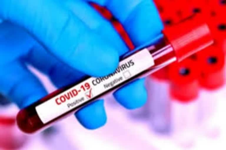 coronavirus home tests