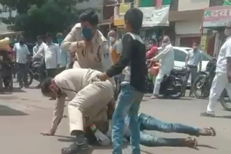 police brutally beaten