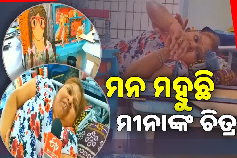 ଚିତ୍ରକଳା ଆଗରେ ହାର ମାନିଲା ଶାରିରୀକ ଦୁର୍ବଳତା