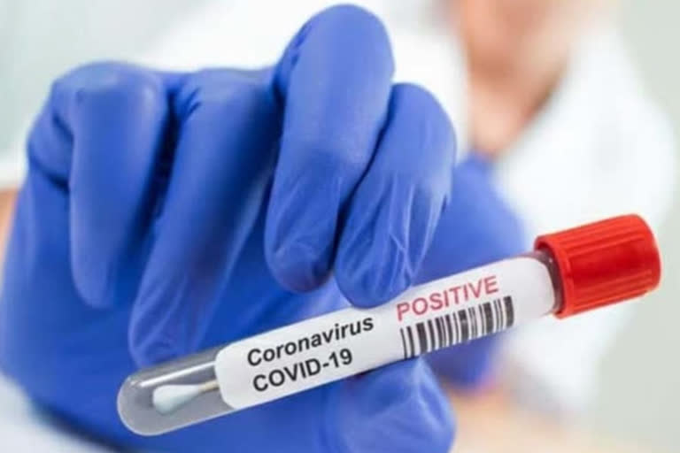 coronavirus