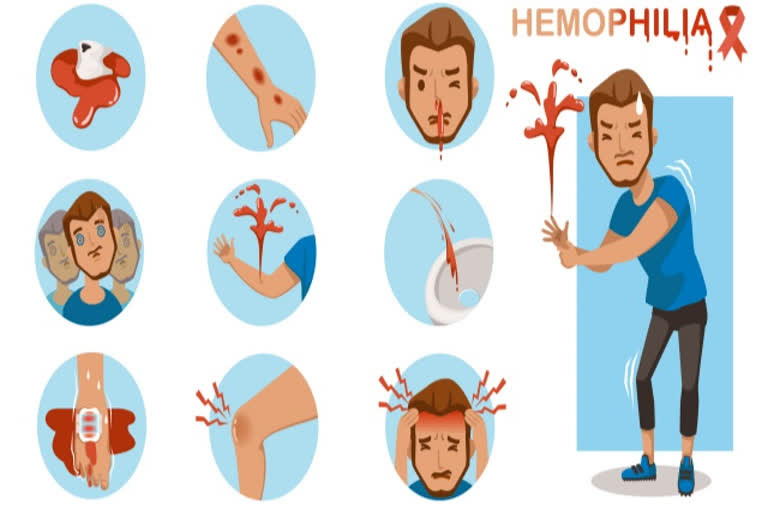 haemophilia a rare bleeding disorder