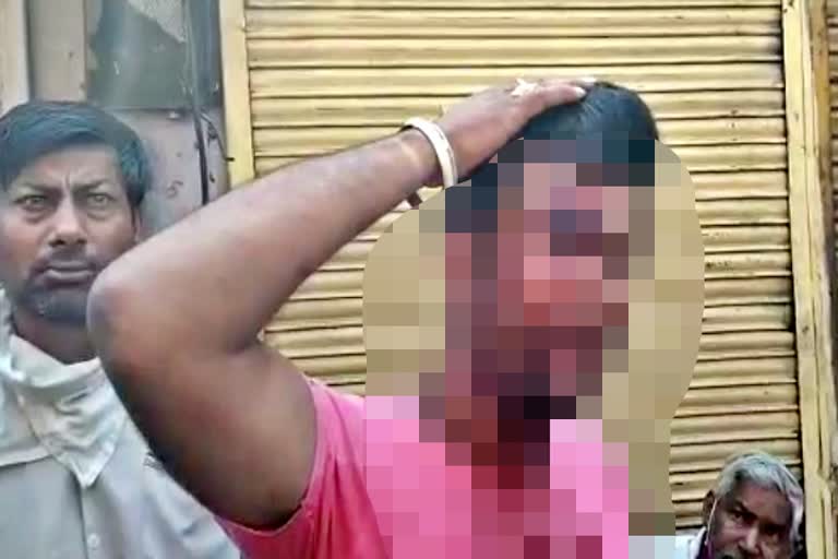 Vegetable seller attacked  attacked with a sword  not giving a week  हफ्ता नहीं देने पर  भरतपुर न्यूज  क्राइम इन भरतपुर  हमला  लहूलुहान  Bled  Attack  Crime in Bharatpur  Bharatpur News  Attack for not giving weeks