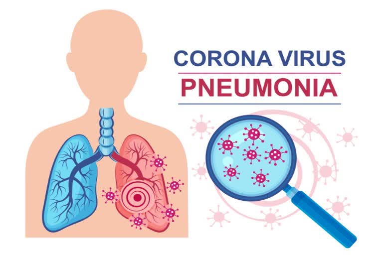 women with covid pneumonia are more at risk of lung damage