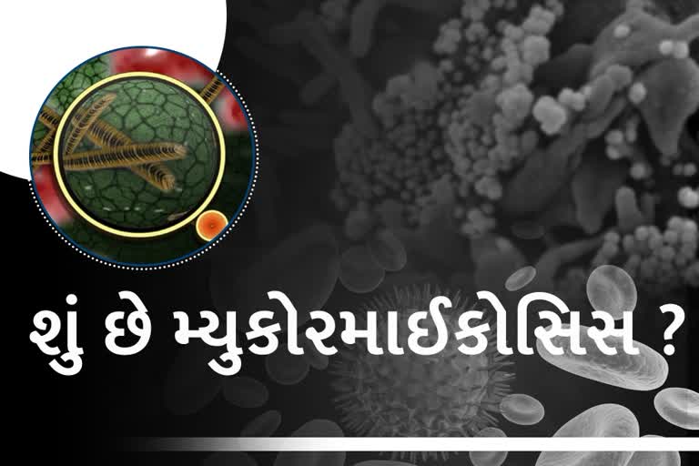 રાજ્યમાં કોરોના સાથે મ્યુકોરમાઈકોસિસનું સંકટ, જાણો શું છે આ બીમારી