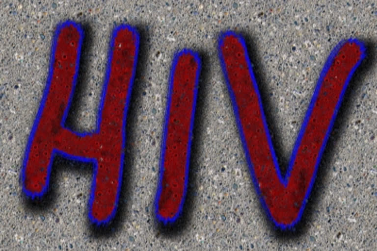 HIV, AIDS, COVID