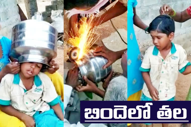 boy head stuck in steel  pot