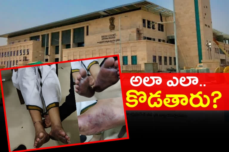 Medical committee set up to look into MP raghu rama krishnama raju injuries