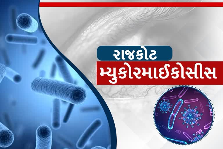 રાજકોટમાં મ્યુકરમાઈકોસિસનો કહેરઃ વધુ 35 દર્દી નોંધાયા