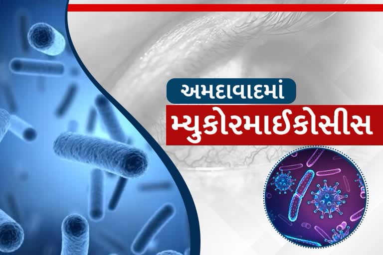 13 વર્ષીય બાળકને થયો મ્યુકોર માયકોસીસ