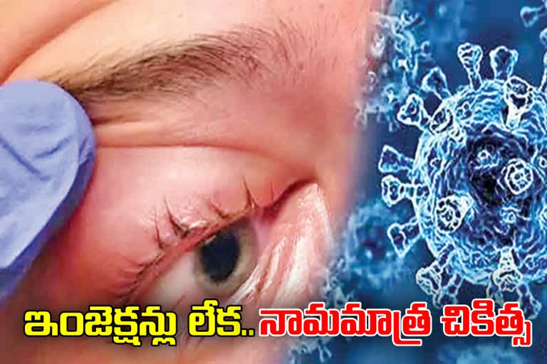 బ్లాక్‌ఫంగస్‌ బాధితులకు వైద్యం ఎలా