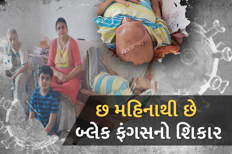 6 મહિનાથી આ યુવક બન્યો છે બ્લેક ફંગસનો શિકાર