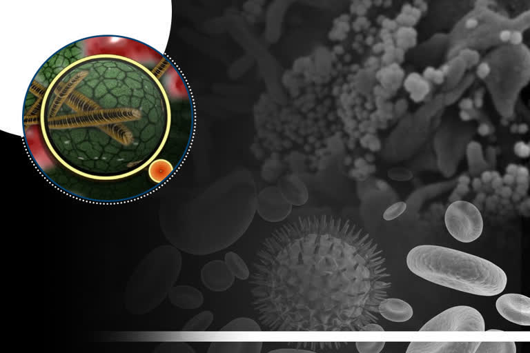 Mucormycosis