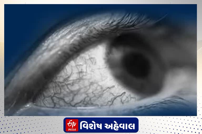 ફંગસનો 100 વર્ષથી પણ જૂનો છે ઇતિહાસ