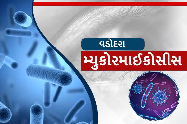 વડોદરામાં મ્યુકોરમાઇકોસિસના નવા 14 દર્દીઓ નોંધાયા, કુલ આંક 325 પર