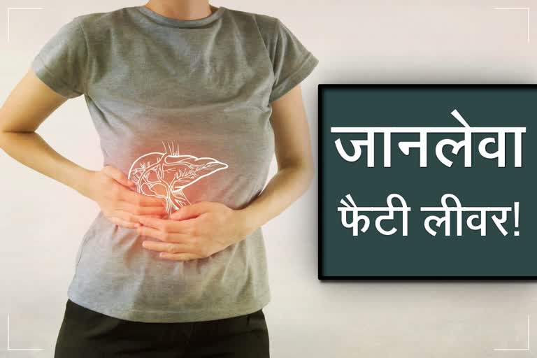 coronavirus infection to people having fatty liver disease chandigarh pgi study