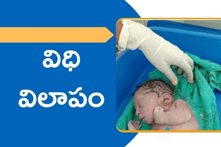 Single legged baby born in Hubli