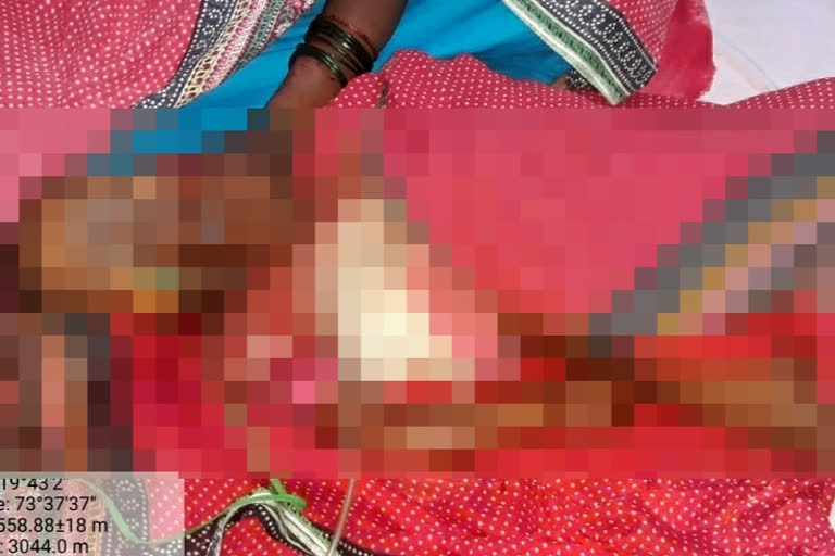 three year old girl died in leopard attack in igatpuri nashik