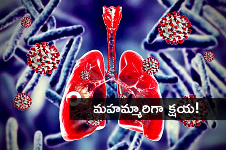 covid affect on tb survivors, క్షయ వ్యాధి కరోనా