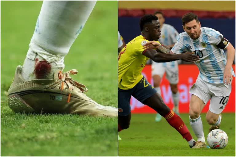 Copa America  Argentina vs Colombia  Bleeding Ankle  Lionel Messi  ലയണല്‍ മെസി  കോപ്പ അമേരിക്ക