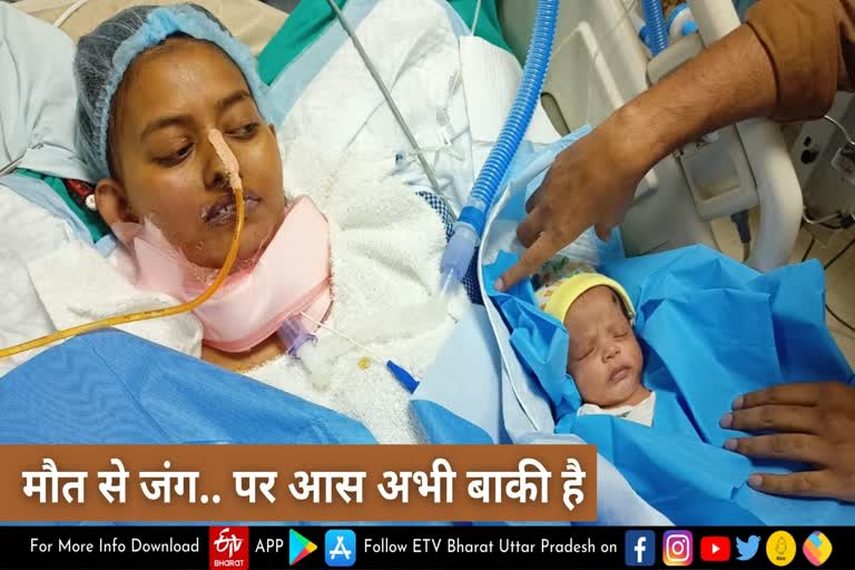 हैदराबाद में होगा लोहिया संस्थान की डॉक्टर के फेफड़े का ट्रांसप्लांट, जानें कितना आएगा खर्च..