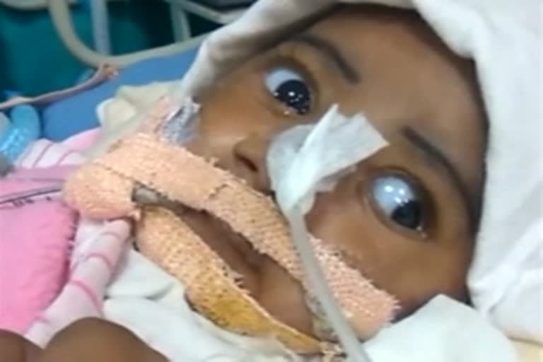 spinal muscular atrophy  Six month old child suffering from SMA died  ഇമ്രാൻ യാത്രയായി  അപൂര്‍വ ജനിതക രോഗമായ സ്‌പൈനല്‍ മസ്‌കുലാര്‍ അട്രോഫി  സ്‌പൈനല്‍ മസ്‌കുലാര്‍ അട്രോഫി  സ്‌പൈനല്‍ മസ്‌കുലാര്‍ അട്രോഫി ബാധിച്ച ഇമ്രാന്‍  Imran suffered spinal muscular atrophy