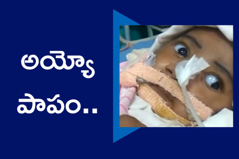 spinal muscular atrophy imran, అరుదైన వ్యాధితో చిన్నారి మృతి