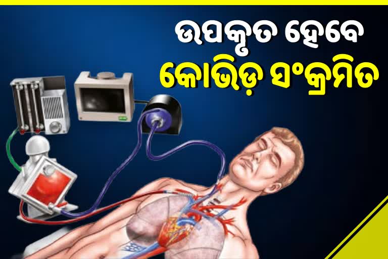 ଓଡ଼ିଶାରେ ଅଗଷ୍ଟ 15ରୁ ECMO ସେବା ଆରମ୍ଭ