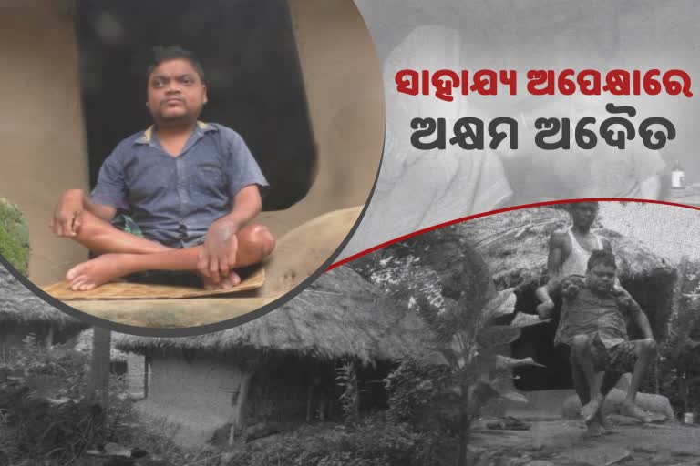 ଦୁଃଖଦୁର୍ଦ୍ଦଶାରେ 32 ବର୍ଷିୟ ଭିନ୍ନକ୍ଷମ ଅଦୈତ୍ୟଙ୍କ ପରିବାର