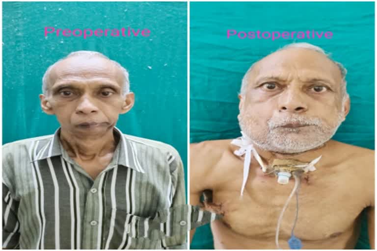 मरीज का नया जबड़ा बनाया, patient new jaw created